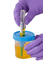 Sistema de recoleccion